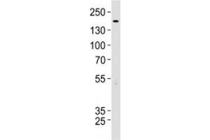 TSC2 antibody western blot analysis in 293 lysate.