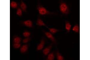 anti-G Protein-Coupled Receptor 75 (GPR75) (Internal Region) antibody
