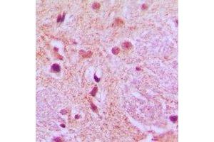 Immunohistochemical analysis of AGFG1 staining in human brain formalin fixed paraffin embedded tissue section.