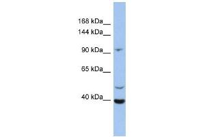 LRRC37B antibody used at 1 ug/ml to detect target protein. (LRRC37B anticorps  (N-Term))