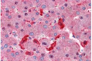 Human Liver: Formalin-Fixed, Paraffin-Embedded (FFPE)