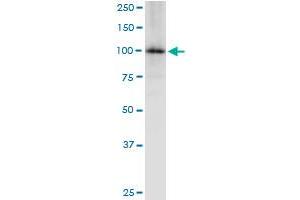 Immunoprecipitation of MTHFD1 transfected lysate using anti-MTHFD1 MaxPab rabbit polyclonal antibody and Protein A Magnetic Bead , and immunoblotted with MTHFD1 purified MaxPab mouse polyclonal antibody (B01P) .