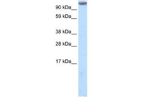 Western Blot showing MKL1 antibody used at a concentration of 1-2 ug/ml to detect its target protein. (MKL1 anticorps  (C-Term))