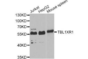 Western blot analysis of extracts of various cell lines, using TBL1XR1 Antibody (ABIN5975754) at 1/1000 dilution. (TBL1XR1 anticorps)