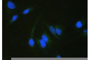 IF analysis of ALDH7A1 using anti-ALDH7A1 antibody (ABIN4886452).