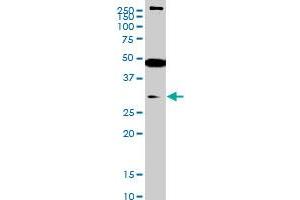 SET7 monoclonal antibody (M01), clone 5B4 Western Blot analysis of SET7 expression in Jurkat .