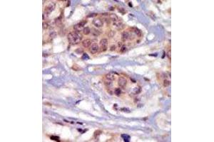 Image no. 1 for anti-FYN Oncogene Related To SRC, FGR, YES (FYN) (N-Term) antibody (ABIN359983) (FYN anticorps  (N-Term))