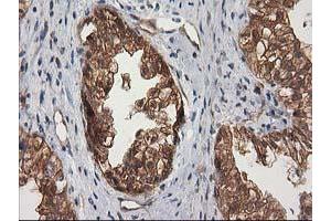 Image no. 7 for anti-Destrin (Actin Depolymerizing Factor) (DSTN) antibody (ABIN1497910) (Destrin anticorps)