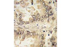 Image no. 3 for anti-SRY (Sex Determining Region Y)-Box 2 (SOX2) (N-Term) antibody (ABIN357437)