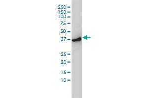Western Blotting (WB) image for anti-Actin-Related Protein 2 (ACTR2) (AA 1-395) antibody (ABIN599116) (ACTR2 anticorps  (AA 1-395))