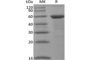 Western Blotting (WB) image for Bromodomain Containing 4 (BRD4) protein (ABIN7319875) (BRD4 Protéine)