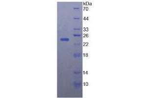 SDS-PAGE analysis of Human Afamin Protein. (Afamin Protein (AFM))