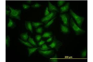 Immunofluorescence (IF) image for anti-SMAD Specific E3 Ubiquitin Protein Ligase 1 (SMURF1) antibody (ABIN781919) (SMURF1 anticorps)