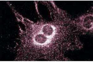 anti-Huntingtin Interacting Protein 1 Related (HIP1R) (AA 560-772) antibody