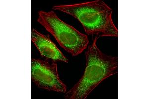 Fluorescent image of Hela cells stained with USP51 Antibody (Center) C. (USP51 anticorps  (AA 278-307))