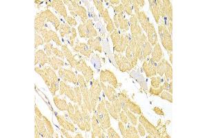 Immunohistochemistry of paraffin-embedded rat heart using RRM2 antibody at dilution of 1:100 (x400 lens). (RRM2 anticorps)