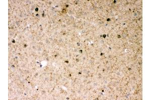 Anti- Parkin Picoband antibody, IHC(P) IHC(P): Mouse Brain Tissue