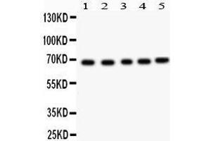 Anti- ACHE Picoband antibody, Western blotting All lanes: Anti ACHE  at 0. (Acetylcholinesterase anticorps  (C-Term))
