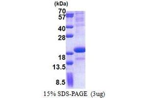SDS-PAGE (SDS) image for Sodium Channel, Voltage-Gated, Type III, beta Subunit (SCN3B) (AA 23-159) protein (His tag) (ABIN7529250)