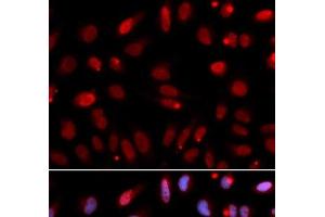 Immunofluorescence analysis of U2OS cells using HUS1 Polyclonal Antibody (HUS1 anticorps)