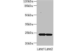 Western blot All lanes: MRAP2 antibody at 7 μg/mL Lane 1: Mouse brain tissue Lane 2: Mouse kidney tissue Secondary Goat polyclonal to rabbit IgG at 1/10000 dilution Predicted band size: 24 kDa Observed band size: 24 kDa (MRAP2 anticorps  (AA 66-205))