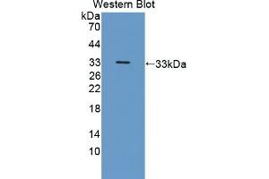 Detection of Recombinant NRP2, Human using Polyclonal Antibody to Neuropilin 2 (NRP2)