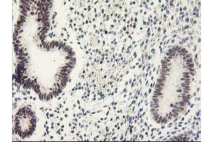 Image no. 4 for anti-General Transcription Factor IIF, Polypeptide 1, 74kDa (GTF2F1) antibody (ABIN1500597)