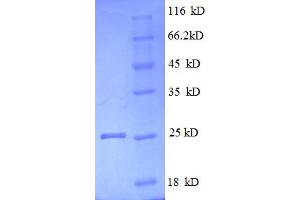 SDS-PAGE (SDS) image for Lymphotoxin beta Receptor (TNFR Superfamily, Member 3) (LTBR) (AA 31-224), (Extracellular) protein (His tag) (ABIN5712558)