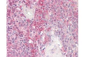 Anti-BID antibody IHC of human spleen.