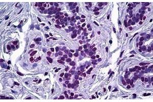 Human Breast, Epithelium: Formalin-Fixed, Paraffin-Embedded (FFPE) (ELAC2 anticorps  (AA 161-210))