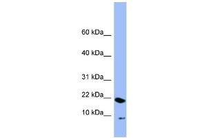 WB Suggested Anti-PIN4  Antibody Titration: 0. (PIN4 anticorps  (N-Term))