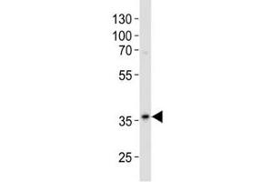Western blot analysis of lysate from A375 cell line using anti-GAPDH antibody diluted at 1:500.