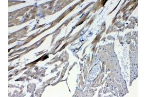 IHC testing of FFPE mouse heart tissue with FZD4 antibody at 1ug/ml.