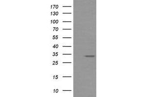 Image no. 2 for anti-Retinoic Acid Receptor Responder (Tazarotene Induced) 1 (RARRES1) antibody (ABIN1500599) (RARRES1 anticorps)
