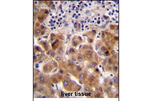 PSORS1C1 Antibody (N-term) (ABIN657118 and ABIN2846264) immunohistochemistry analysis in formalin fixed and paraffin embedded human liver tissue followed by peroxidase conjugation of the secondary antibody and DAB staining.