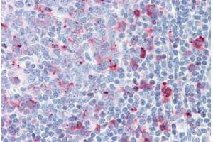 Human Tonsil: Formalin-Fixed, Paraffin-Embedded (FFPE) (CTSC anticorps)