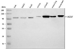 Western blot analysis of OGDH using anti-OGDH antibody (ABIN7598935).