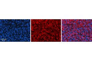 Rabbit Anti-PROC Antibody   Formalin Fixed Paraffin Embedded Tissue: Human Liver Tissue Observed Staining: Cytoplasm in hepatocytes Primary Antibody Concentration: 1:100 Other Working Concentrations: 1:600 Secondary Antibody: Donkey anti-Rabbit-Cy3 Secondary Antibody Concentration: 1:200 Magnification: 20X Exposure Time: 0.