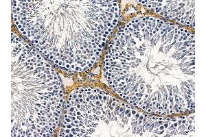 ABIN6258237 and ABIN6274591 at 1/100 staining rat testis tissue by IHC-P. (AVEN anticorps  (C-Term))