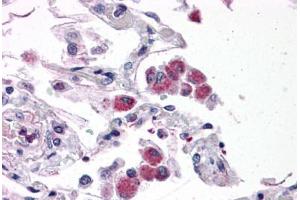Human Lung: Formalin-Fixed, Paraffin-Embedded (FFPE) (FAM59B anticorps  (C-Term))