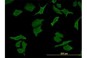 Immunofluorescence of monoclonal antibody to DPYD on HeLa cell.