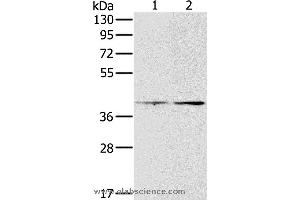 Western blot analysis of Hela and lovo cell, using PDGFRL Polyclonal Antibody at dilution of 1:400 (PDGFRL anticorps)