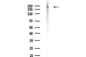 Western blot analysis of lysates from K562 cells(UV,30 min treatment), using Phospho-Bcr (Tyr360) Antibody at 1/1000 dilution.