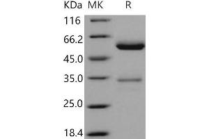 Western Blotting (WB) image for F11 Receptor (F11R) protein (Fc Tag) (ABIN7320271) (F11R Protein (Fc Tag))