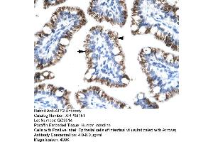 Human Intestine (ATF2 anticorps  (C-Term))