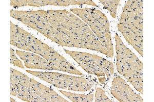 ABIN7096733 and ABIN7100798 at 1/100 staining rat muscle tissue by IHC-P. (TRABD anticorps)