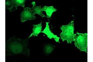 Anti-LDLRAP1 mouse monoclonal antibody (ABIN2455230) immunofluorescent staining of COS7 cells transiently transfected by pCMV6-ENTRY LDLRAP1 (RC206643). (LDLRAP1 anticorps)
