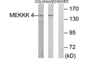 Western blot analysis of extracts from HuvEc/COLO cells, using MEKKK 4 Antibody.
