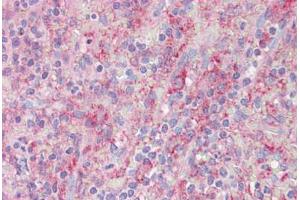 Anti-CNTROB antibody IHC staining of human spleen. (CNTROB anticorps  (AA 591-640))
