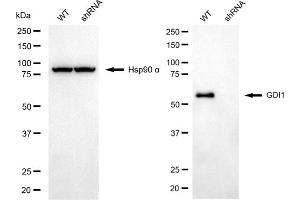 Western blotting analysis using GDI1 antibody (ABIN7798699). (GDI1 anticorps)